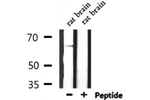 Western blot analysis of extracts from rat brain, using SLC6A1 Antibody. (SLC6A1 抗体  (Internal Region))