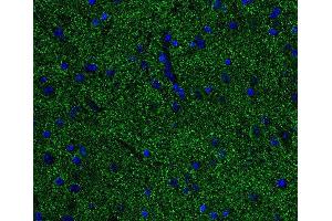Indirect immunostaining of PFA fixed paraffin embedded mouse spinal cord section (dilution 1 : 500; green). (Alpha, beta Synuclein 抗体)