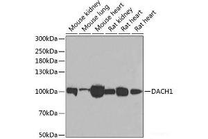 Western blot analysis of extracts of various cell lines using DACH1 Polyclonal Antibody at dilution of 1:1000.
