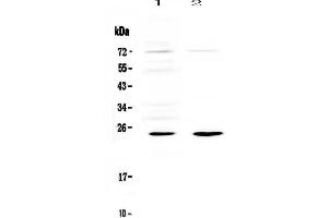 Western blot analysis of IL6 using anti-IL6 antibody . (IL-6 抗体)