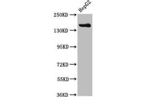 Western Blot Positive WB detected in: HepG2 whole cell lysate All lanes: CPS1 antibody at 3. (CPS1 抗体  (AA 1361-1500))