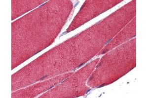 IHC-P Image Immunohistochemical analysis of paraffin-embedded human skeletal muscle, using alpha Actin (skeletal muscle), antibody(10 μg/ml). (Actin 抗体)
