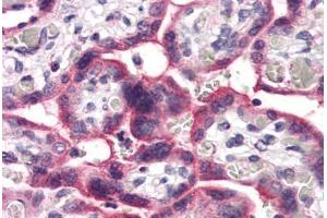 Immunohistochemistry (IHC) image for anti-Solute Carrier Family 5 (Iodide Transporter), Member 6 (SLC5A6) (Internal Region) antibody (ABIN1049347)