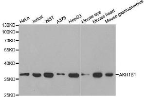 Western blot analysis of extracts of various cell lines, using AKR1B1 antibody. (AKR1B1 抗体  (AA 1-316))