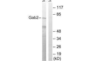 Western blot analysis of extracts from Jurkat cells, treated with TNF (2500U/ml, 30mins), using Gab2 (epitope around residue 623) antibody. (GAB2 抗体  (Ser623))