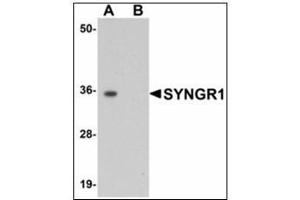 Western blot analysis of SYNGR1 in rat brain tissue lysate with SYNGR1 antibody at 1 µg/ml in (A) the absence and (B) the presence of blocking peptide. (Synaptogyrin 1 抗体)