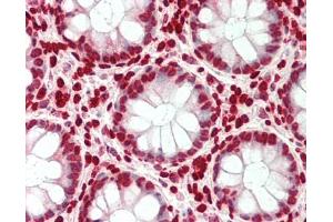 Human Colon: Formalin-Fixed, Paraffin-Embedded (FFPE).