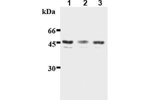 Western Blotting (WB) image for anti-Inhibitor of kappa Light Polypeptide Gene Enhancer in B-Cells, Kinase gamma (IKBKG) (AA 61-137) antibody (ABIN567773) (IKBKG 抗体  (AA 61-137))