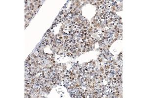 Immunohistochemistry of paraffin-embedded mouse fetal liver using Survivin Rabbit pAb (ABIN6132229, ABIN6137562, ABIN6137563 and ABIN6218613) at dilution of 1:100 (40x lens).
