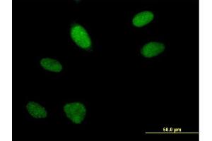 Immunofluorescence of purified MaxPab antibody to FLJ10154 on HeLa cell. (ARGLU1 抗体  (AA 1-273))