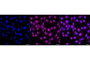 Immunocytochemical staining of C2C12 cells with AKT1 antibody (ABIN7800783), 1:1,000). (Recombinant AKT1 抗体)