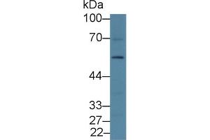 Western blot analysis of Rat Liver lysate, using Rat DRD2 Antibody (2 µg/ml) and HRP-conjugated Goat Anti-Rabbit antibody ( (Dopamine d2 Receptor 抗体  (AA 194-421))