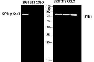 Western Blot (WB) analysis of 293T 3T3 COLO205 using SYN1 antibody. (SYN1 抗体)