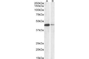 ABIN2561997 (0. (CREB1 抗体  (AA 96-109))