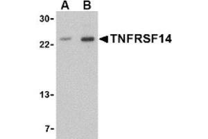 Image no. 1 for anti-Tumor Necrosis Factor Receptor Superfamily, Member 14 (TNFRSF14) (N-Term) antibody (ABIN265160) (HVEM 抗体  (N-Term))