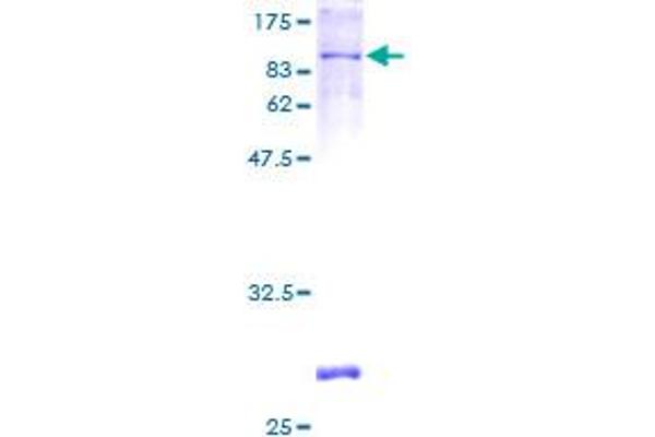 PDE4D Protein (AA 1-518) (GST tag)