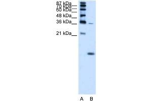 WB Suggested Anti-HBZ Antibody Titration:  1. (HBZ 抗体  (N-Term))