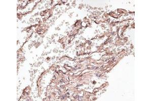 Immunohistochemistry of paraffin-embedded Human lung using COL6A1 Polyclonal Antibody at dilution of 1:100 (40x lens). (COL6A1 抗体)