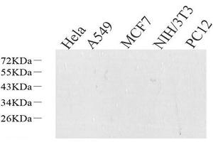 Western Blot analysis of various samples using S100A4 Polyclonal Antibody at dilution of 1:600. (s100a4 抗体)