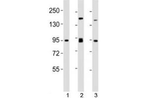 Western blot testing of SUZ12 antibody at 1:2000 dilution. (SUZ12 抗体  (AA 375-408))