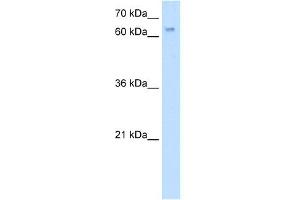 WB Suggested Anti-RBM35A Antibody Titration:  5. (ESRP1 抗体  (N-Term))