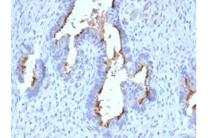 Formalin-fixed, paraffin-embedded human Endometrium stained with Podocalyxin Mouse Monoclonal Antibody (PODXL/2185). (PODXL 抗体  (AA 310-447))