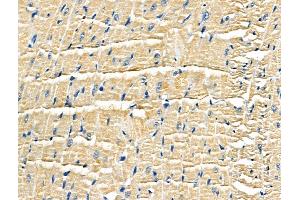 ABIN6259653 and ABIN6266917 at 1/100 staining Rat heart tissue by IHC-P. (Serotonin Receptor 5A 抗体  (Internal Region))