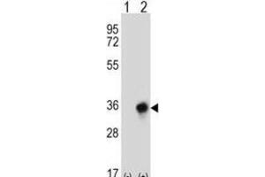 Western Blotting (WB) image for anti-Carbonyl Reductase 3 (CBR3) antibody (ABIN2997011) (CBR3 抗体)