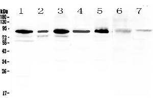 Western blot analysis of MED15 using anti-MED15 antibody . (MED15 抗体  (AA 1-285))