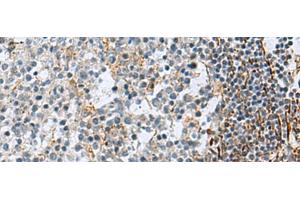 Immunohistochemistry of paraffin-embedded Human tonsil tissue using GLS Polyclonal Antibody at dilution of 1:70(x200) (Glutaminase 抗体)