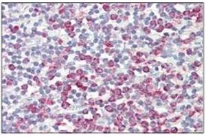 Human Tonsil: Formalin-Fixed, Paraffin-Embedded (FFPE) (ATP5G2 抗体  (N-Term))
