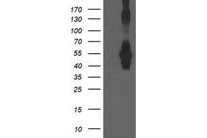 Western Blotting (WB) image for anti-Cerebral Cavernous Malformation 2 (CCM2) antibody (ABIN1497136) (CCM2 抗体)