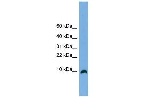 WB Suggested Anti-C18orf56 Antibody Titration: 0. (C18orf56 抗体  (N-Term))
