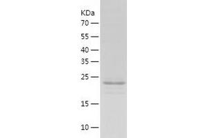 Western Blotting (WB) image for alpha-Actinin Skeletal Muscle (ACTN) (AA 1-249) protein (His tag) (ABIN7285351) (alpha Actinin Protein (AA 1-249) (His tag))