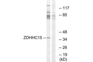 Western Blotting (WB) image for anti-Zinc Finger, DHHC-Type Containing 15 (ZDHHC15) (C-Term) antibody (ABIN1851773) (ZDHHC15 抗体  (C-Term))