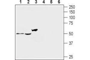 Western blot analysis of rat DRG (lanes 1 and 4), mouse brain (lanes 2 and 5) and human brain neuroblastoma SH-SY5Y (lanes 3 and 6) lysates: - 1-3. (HTR2A 抗体  (Extracellular))