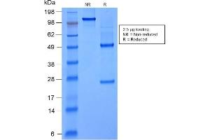 SDS-PAGE Analysis Purified FOXA1 Mouse Recombinant Monoclonal Antibody (rFOXA1/1515). (Recombinant FOXA1 抗体  (AA 372-472))