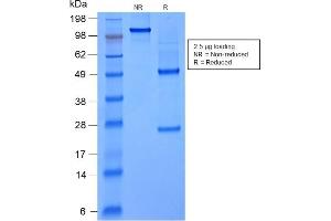 SDS-PAGE Analysis Purified FOXA1 Mouse Recombinant Monoclonal Antibody (rFOXA1/1515).