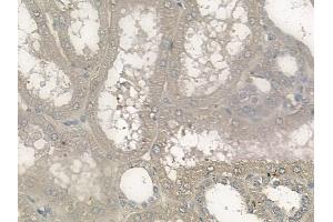 ABIN6265846 and ABIN6272476 at 1/100 staining human normal kidney tissue by IHC-P. (UBE2E3 抗体  (N-Term))