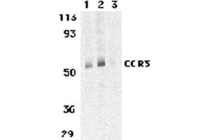 Image no. 2 for anti-Chemokine (C-C Motif) Receptor 3 (CCR3) (C-Term) antibody (ABIN205726) (CCR3 抗体  (C-Term))