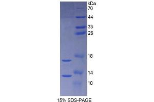 SDS-PAGE analysis of Rat Synuclein alpha Protein. (SNCA 蛋白)