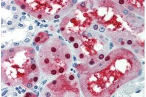 anti-GATA Binding Protein 3 (GATA3) (AA 36-85) antibody