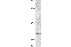 Western blot analysis of Jurkat cell, using PTGER1 Polyclonal Antibody at dilution of 1:500