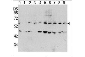 Western blot analysis of phospho c-Myc antibody and human TPA activated HeLa cells/lysate (0: without TPA; 1: 60ug/ml TPA-15min; 2: 60ug/ml-30min; 3: 60ug/ml-45min; 4: 125ug/ml-15min; 5: 125ug/ml-30min; 6: 125ug/ml-45min; 7: 250ug/ml-15min; 8: 250ug/ml-30 (c-MYC 抗体  (pThr58))