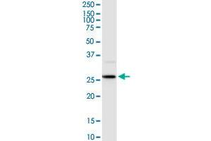HOXB9 MaxPab rabbit polyclonal antibody. (HOXB9 抗体  (AA 1-250))
