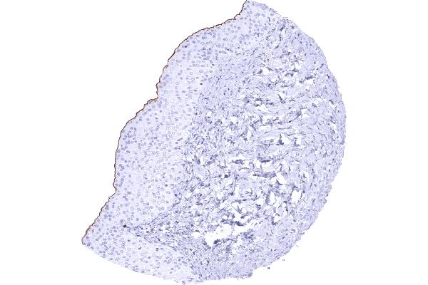 Uroplakin 3B 抗体