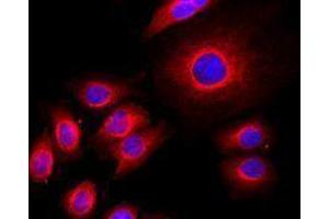 Immunofluorescence (IF) image for anti-alpha Tubulin (TUBA1) antibody (Alexa Fluor 647) (ABIN2657233)