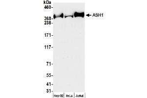 Western Blotting (WB) image for anti-Achaete-Scute Complex Homolog 1 (Drosophila) (ASCL1) (AA 2919-2969) antibody (ABIN7453478) (ASCL1 抗体  (AA 2919-2969))