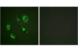 Immunofluorescence analysis of HeLa cells, using EPHA2/3/4 (Phospho-Tyr588/596) antibody. (EPHA2/3 抗体  (pTyr588, pTyr596))