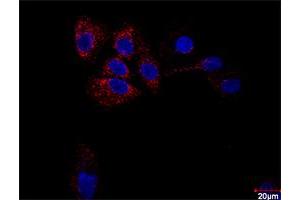 Confocal microscopy image of Proximity Ligation Assay of protein-protein interactions between HDAC2 and RELA. (HDAC2 & RELA Protein Protein Interaction Antibody Pair)